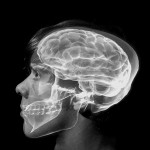 Photo: "O is for Occipital Lobe" by Eric on Flickr. Used under Creative Commons license.