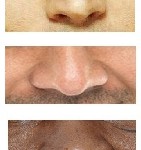noses