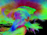 Can We Preserve Brains? Can We Preserve You?