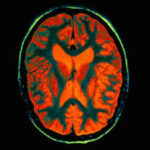 Memory Champ: Trick Your Brain To Remember