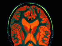 Memory Champ: Trick Your Brain To Remember