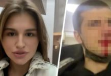 Hermitage Employee Breaks Visitor’s Nose (Captured On Social Media, Of Course)