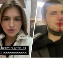 Hermitage Employee Breaks Visitor’s Nose (Captured On Social Media, Of Course)