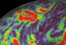 Cool – A Brain Scan! But What Does It Mean?