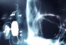 Sure, Music Can Heal – But Can It Heal Bones?