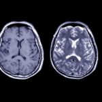 Coming: A Digital Copy Of Your Brain