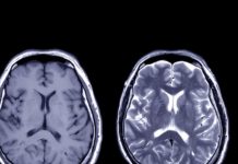 Coming: A Digital Copy Of Your Brain