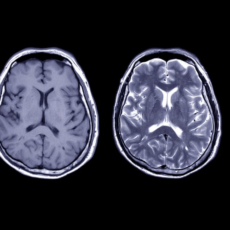 Coming: A Digital Copy Of Your Brain