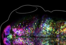 Scientists Watch A Memory Being Formed In A Living Brain