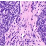 What Cancer Therapy Is Teaching Us About The Vast Complexity Of The Human Condition