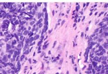 What Cancer Therapy Is Teaching Us About The Vast Complexity Of The Human Condition