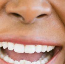 Why We Laugh