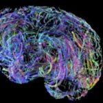 How Your Brain Rewires Itself In Your 40s
