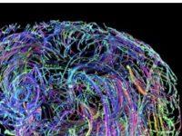 How Your Brain Rewires Itself In Your 40s