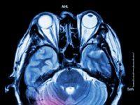 Can A Powerful Book Really Rewire Your Brain? A Neuropsychologist Tried To Find Out.