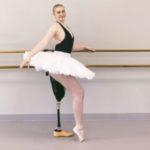 Dancer Has Leg Amputated, Then Carries On Dancing