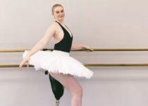 Dancer Has Leg Amputated, Then Carries On Dancing