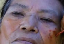 Dance Is Easing Some Pain For Survivors Of Civil War In Peru