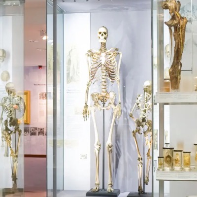 English Museum Finally Removes Skeleton Of Man Called Irish Giant