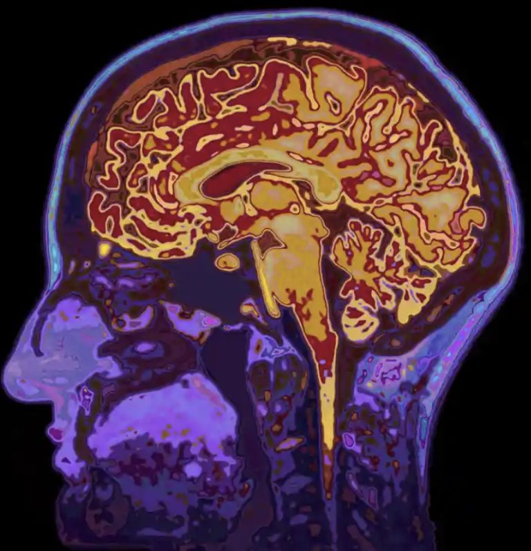 Scientists: Human Memory Can Be Unreliable Almost Immediately
