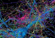 Progress On Mapping The Brain Has Been Painstaking. AI Might Change That