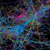 Progress On Mapping The Brain Has Been Painstaking. AI Might Change That