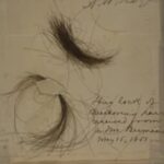 Yet More Evidence That Beethoven Had Severe Lead Poisoning