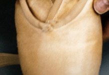 Less Painful Ballet Shoes Are Available, At Last