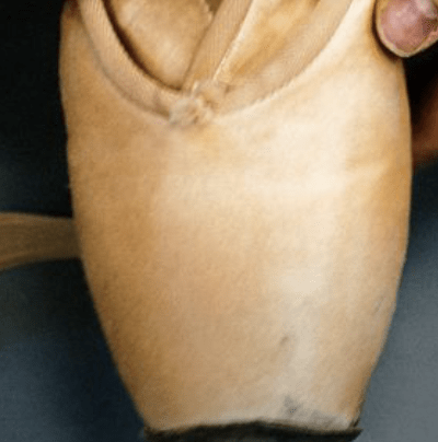 Less Painful Ballet Shoes Are Available, At Last