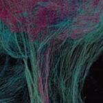 Study: Those Who Learn A Second Language Develop More Brain Connections