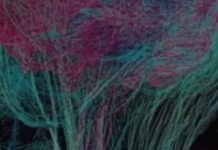 Study: Those Who Learn A Second Language Develop More Brain Connections