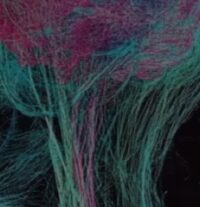 Study: Those Who Learn A Second Language Develop More Brain Connections