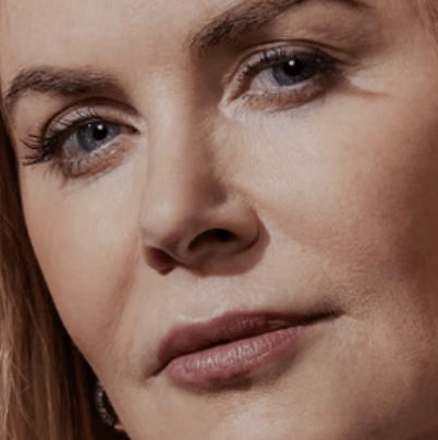 Nicole Kidman On Taking Risks, And Sharks