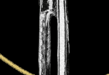 When Hobbies Like Knitting And Fishing Become Too Expensive, We All Lose