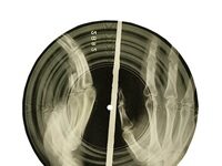 “Bone Records” — How Forbidden Jazz And Rock Were Smuggled Into The Soviet Union On X-Ray Film