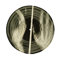 “Bone Records” — How Forbidden Jazz And Rock Were Smuggled Into The Soviet Union On X-Ray Film