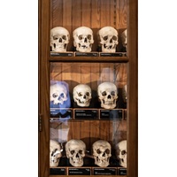 America’s Leading Medical Museum Changes The Way It Displays Human Remains