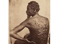 Why Suppressing The Photo Of An Enslaved Man’s Whipped Back Is A Horrifying Idea