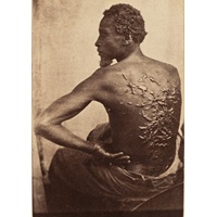 Why Suppressing The Photo Of An Enslaved Man’s Whipped Back Is A Horrifying Idea
