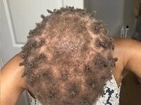 Black Actress Sues Harvard’s American Repertory Theater For Discrimination, Alleging Permanent Scalp Damage