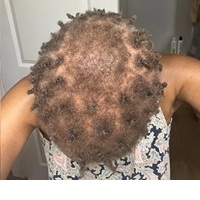 Black Actress Sues Harvard’s American Repertory Theater For Discrimination, Alleging Permanent Scalp Damage