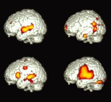 New Brain Study Reveals How Bilingual People Process Language